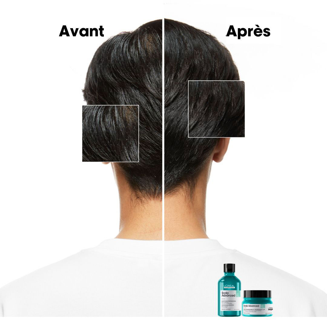 Avant/après utilisation de la gamme Scalp Advanced